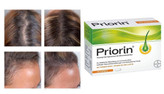 کپسول ضد ریزش مو آلمانی پریورین PRIORIN Kapseln 120 St PRIORIN Kapseln 120 St