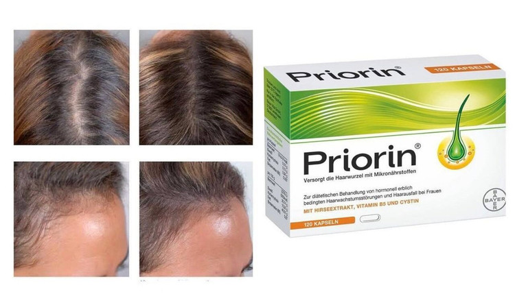 کپسول ضد ریزش مو آلمانی پریورین PRIORIN Kapseln 120 St PRIORIN Kapseln 120 St