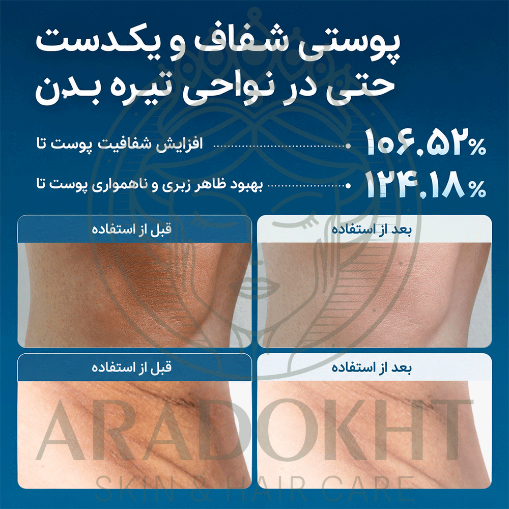 اسپری پیل شات بدن ترانگزامیک اسید دکتر ملاکسین روشن کننده و لایه بردار ملایم Dr.Melaxin Peel Shot Exfoliating TX-Sprayاصلی به شرط ضمانت