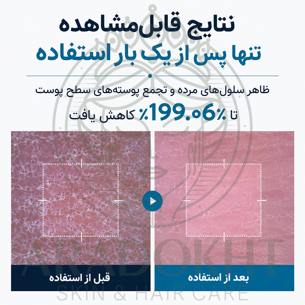 اسپری پیل شات بدن ترانگزامیک اسید دکتر ملاکسین روشن کننده و لایه بردار ملایم Dr.Melaxin Peel Shot Exfoliating TX-Sprayاصلی به شرط ضمانت