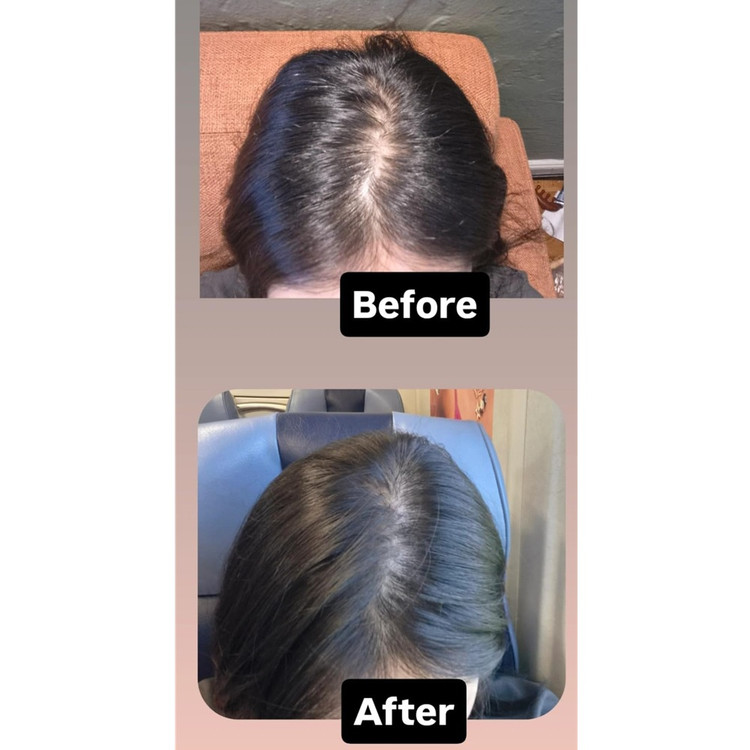 آمپول ضد ریزش و تقویت رشد مو اگزوزوم اسپیکول 3000 گروترن لیلیوئه